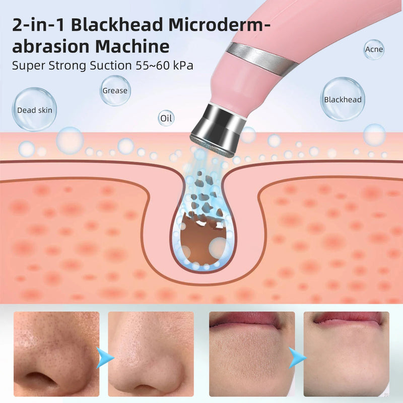 Máquina portátil de microdermoabrasão de diamante, dispositivo de peeling facial, esfoliação a vácuo, removedor de cravos com 4 pontas de peeling de diamante