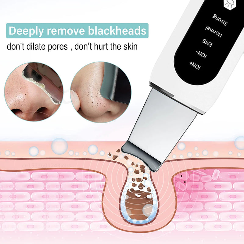 Esfoliante ultrassônico para pele, limpeza profunda ultrassônica do rosto, peeling, removedor de cravos, pá de limpeza facial, lifting, cuidados com a pele