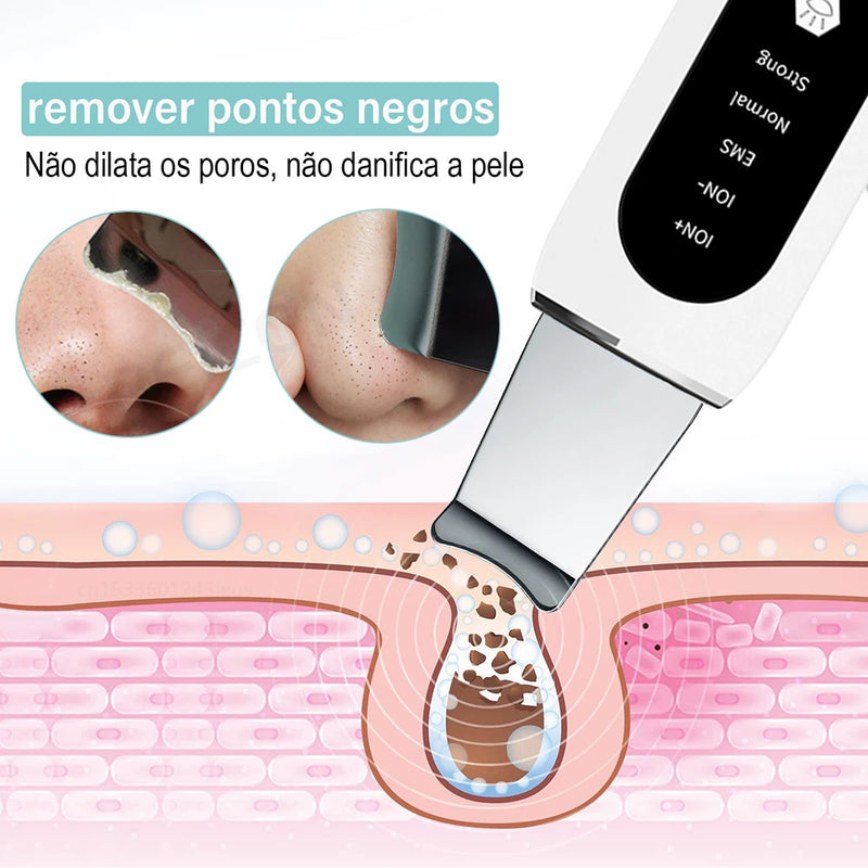 Esfoliante ultrassônico para pele, limpeza profunda ultrassônica do rosto, peeling, removedor de cravos, pá de limpeza facial, lifting, cuidados com a pele