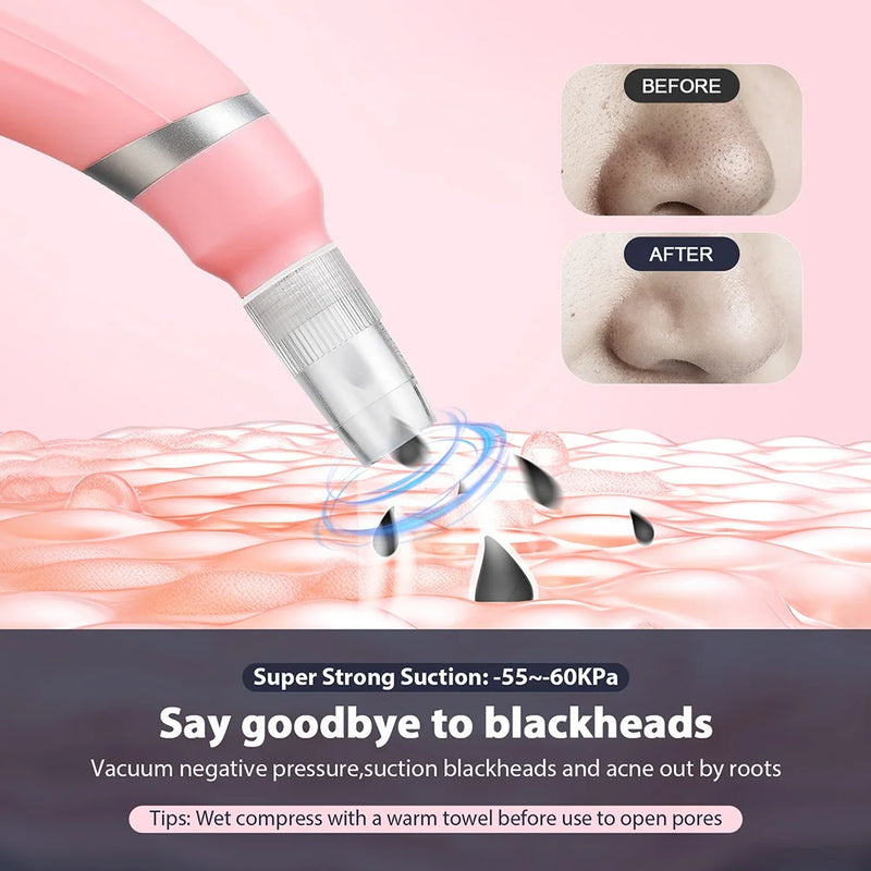 Máquina portátil de microdermoabrasão de diamante, dispositivo de peeling facial, esfoliação a vácuo, removedor de cravos com 4 pontas de peeling de diamante