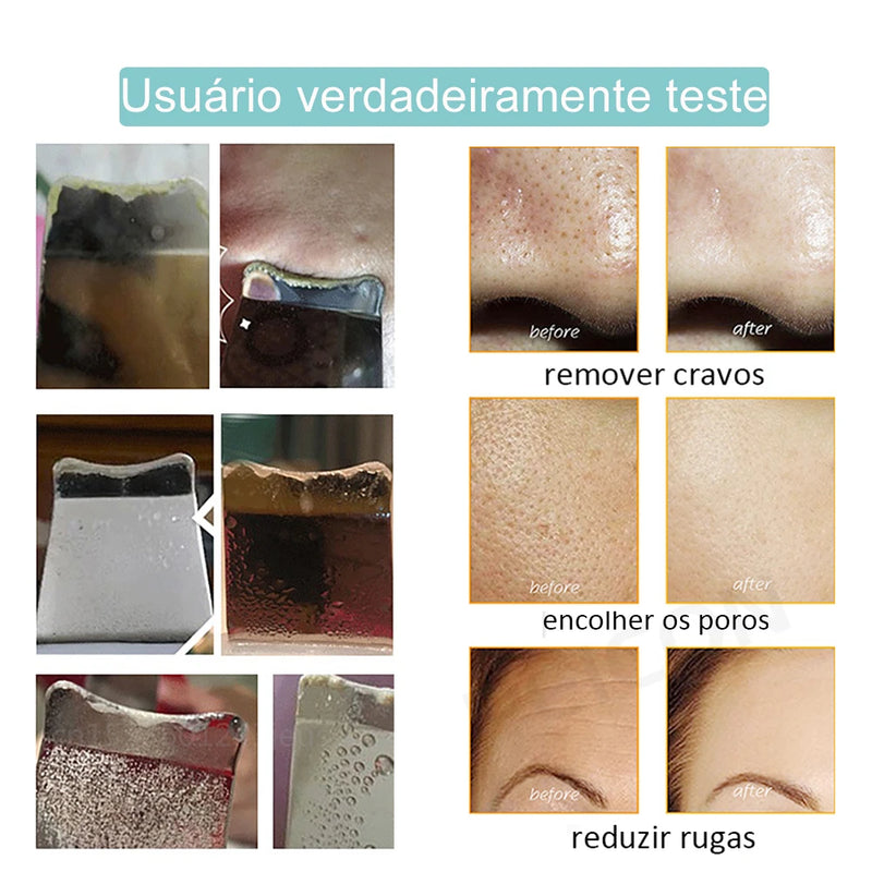 Esfoliante ultrassônico para pele, limpeza profunda ultrassônica do rosto, peeling, removedor de cravos, pá de limpeza facial, lifting, cuidados com a pele