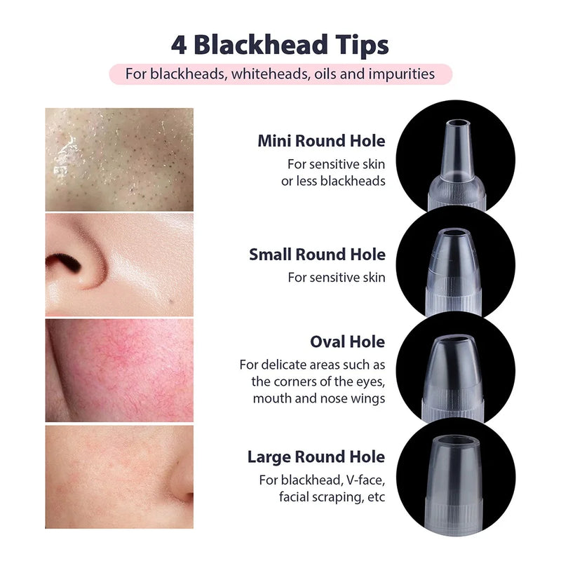 Máquina portátil de microdermoabrasão de diamante, dispositivo de peeling facial, esfoliação a vácuo, removedor de cravos com 4 pontas de peeling de diamante