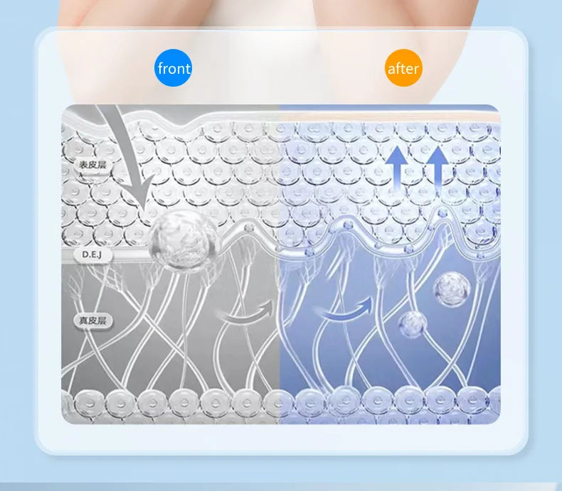 Removedor de queixo duplo, vibração, queixo para cima, massageador facial em V, levantador facial EMS, dispositivo de beleza, cinto modelador de lifting facial em V