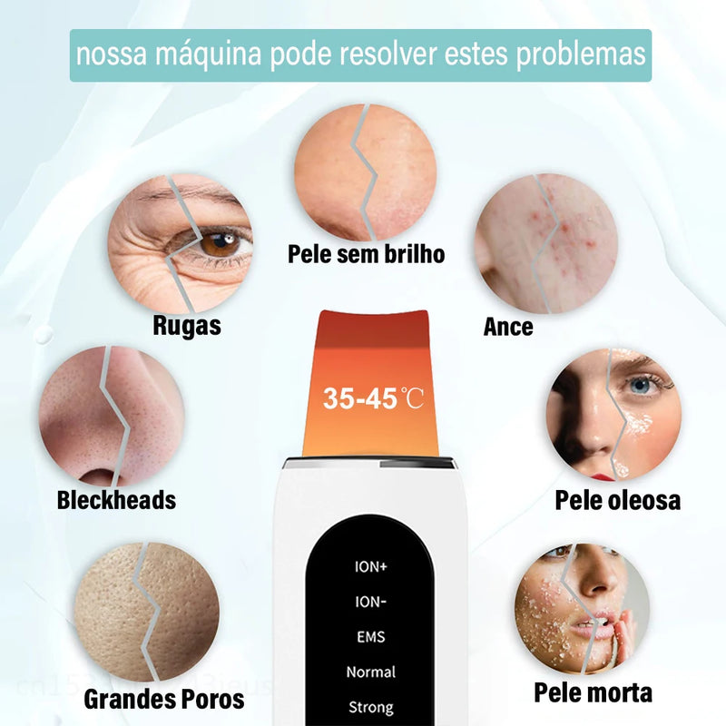 Esfoliante ultrassônico para pele, limpeza profunda ultrassônica do rosto, peeling, removedor de cravos, pá de limpeza facial, lifting, cuidados com a pele