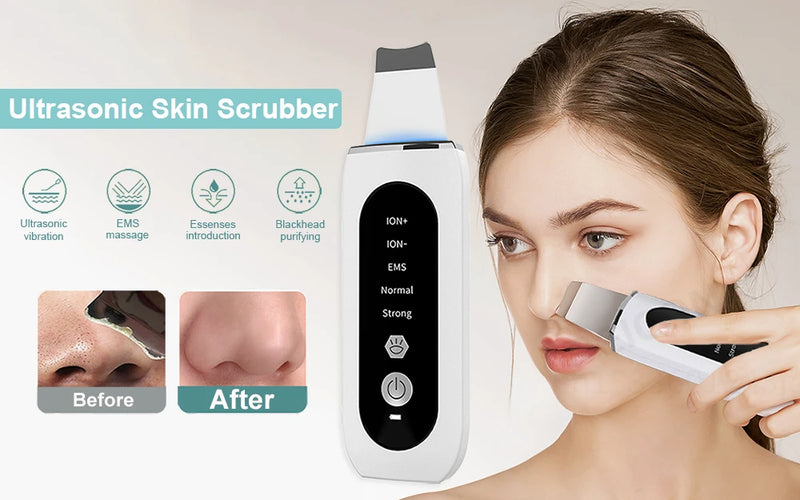 Esfoliante ultrassônico para pele, limpeza profunda ultrassônica do rosto, peeling, removedor de cravos, pá de limpeza facial, lifting, cuidados com a pele