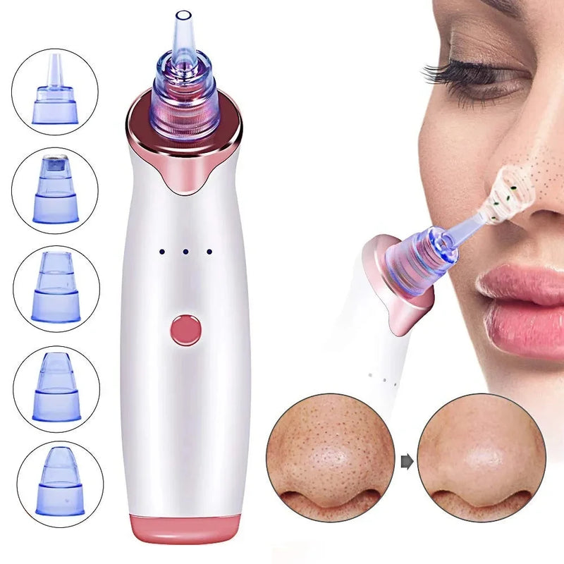 Suction Machine Remove Blackheads Pimples Acne Vacuum Suction
