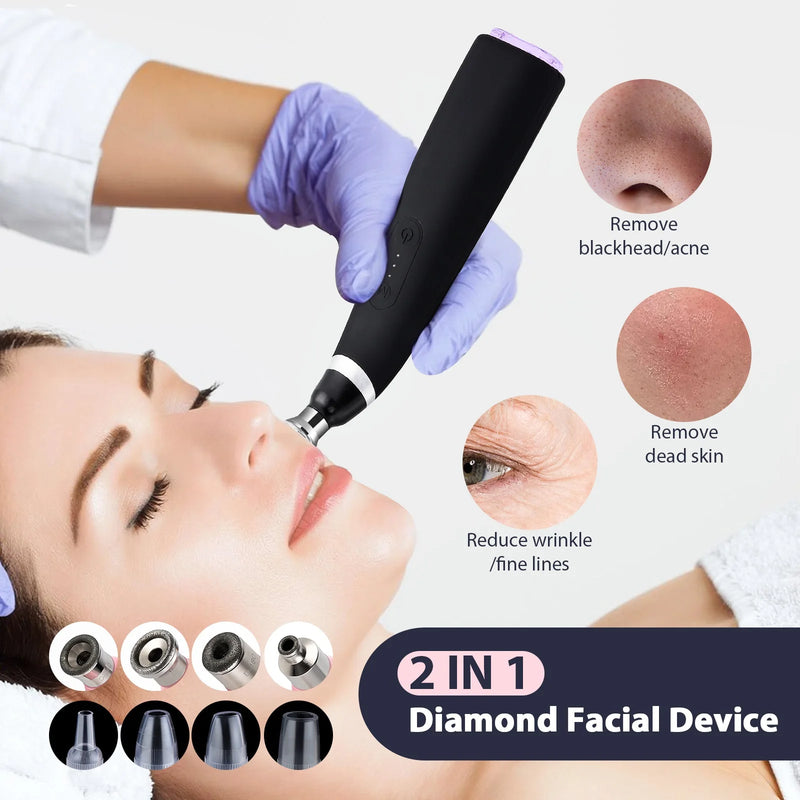 Máquina portátil de microdermoabrasão de diamante, dispositivo de peeling facial, esfoliação a vácuo, removedor de cravos com 4 pontas de peeling de diamante
