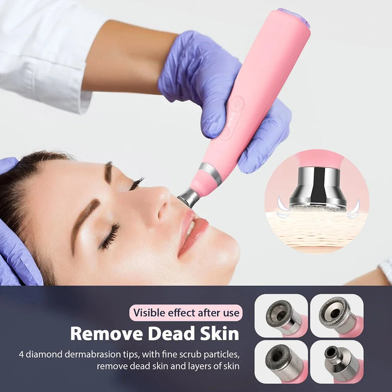 Máquina portátil de microdermoabrasão de diamante, dispositivo de peeling facial, esfoliação a vácuo, removedor de cravos com 4 pontas de peeling de diamante