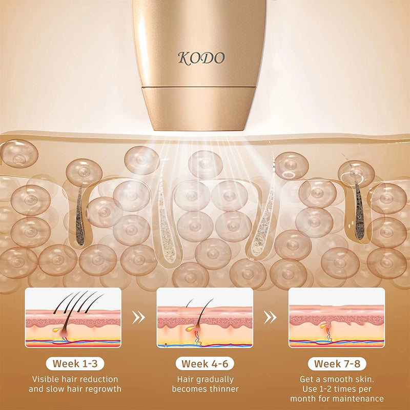 KODO 2025 Depilação a laser de gelo de alta personalização de ponta Depilador a laser IPL permanente Fotoepilador indolor 4 em 1 rosto e corpo