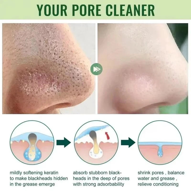 Máscara Facial Original Removedora de Cravos e Chá Verde Sólida, Trata Acne, Manchas e Pontos Pretos, Creme em Bastão para Limpeza, Diminui Poros e Cuidados com a Pele