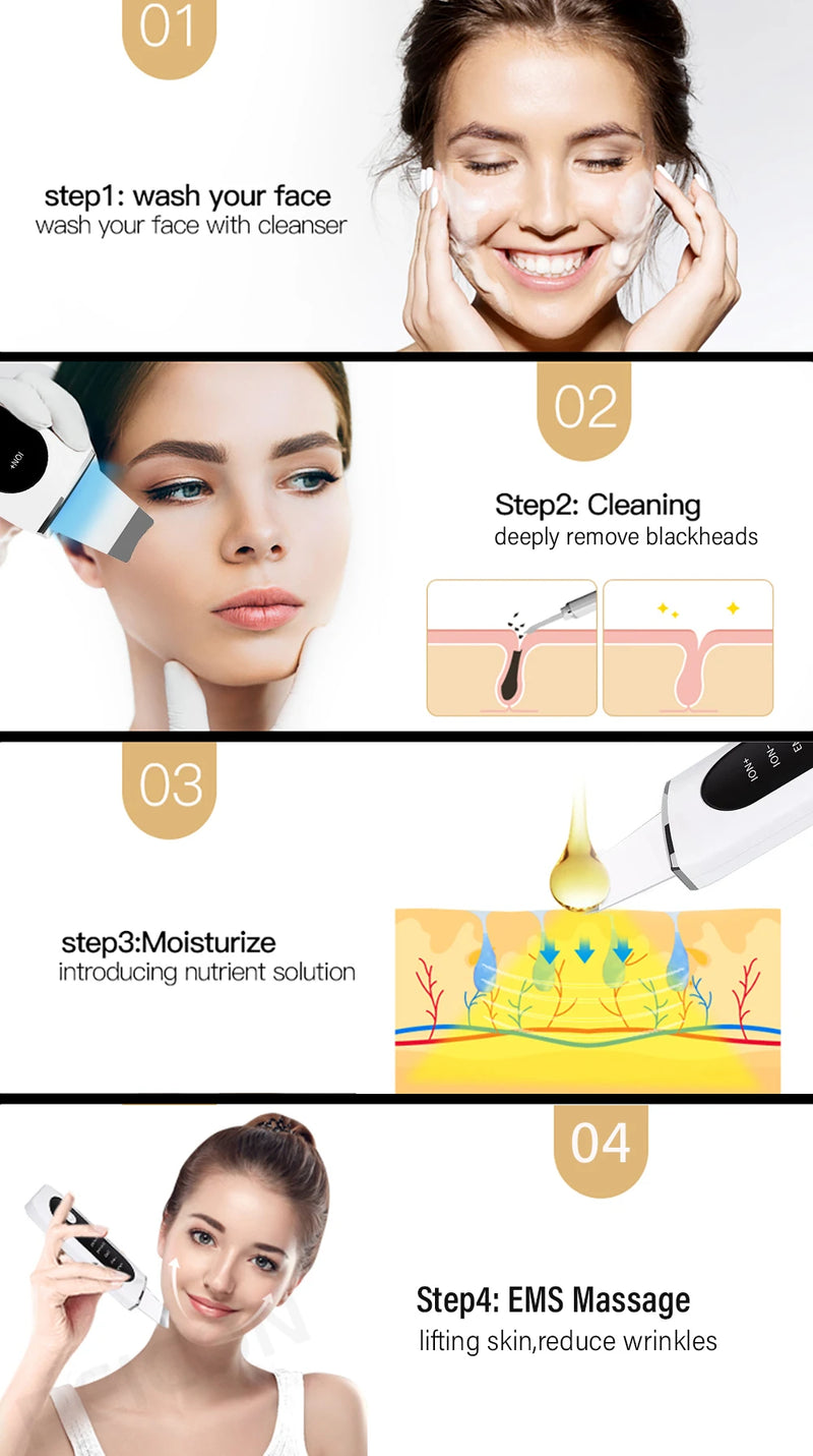 Esfoliante ultrassônico para pele, limpeza profunda ultrassônica do rosto, peeling, removedor de cravos, pá de limpeza facial, lifting, cuidados com a pele