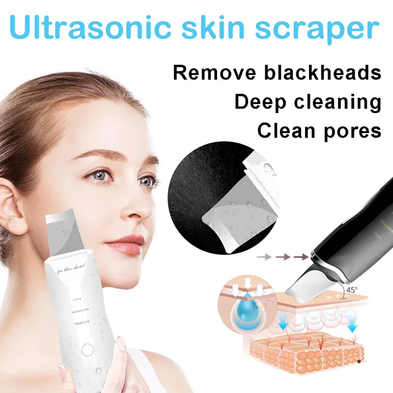 Esfoliante ultrassônico para pele, peeling, removedor de cravos, limpeza profunda do rosto, limpador de poros de acne, pá facial, limpador EMS de microcorrente