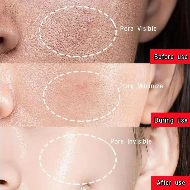 Máscara Facial Original Removedora de Cravos e Chá Verde Sólida, Trata Acne, Manchas e Pontos Pretos, Creme em Bastão para Limpeza, Diminui Poros e Cuidados com a Pele