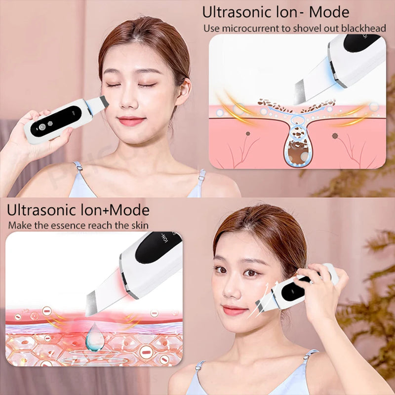 Esfoliante ultrassônico para pele, limpeza profunda ultrassônica do rosto, peeling, removedor de cravos, pá de limpeza facial, lifting, cuidados com a pele
