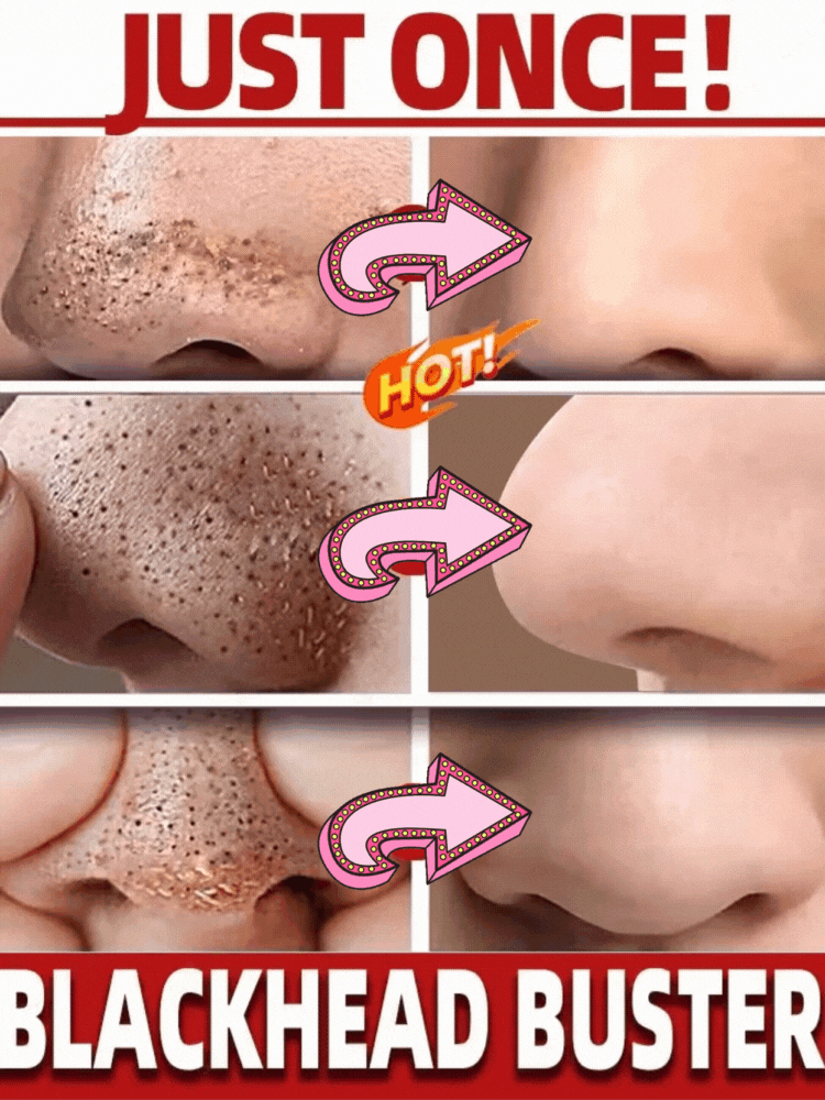 Máscara Facial Original Removedora de Cravos e Chá Verde Sólida, Trata Acne, Manchas e Pontos Pretos, Creme em Bastão para Limpeza, Diminui Poros e Cuidados com a Pele
