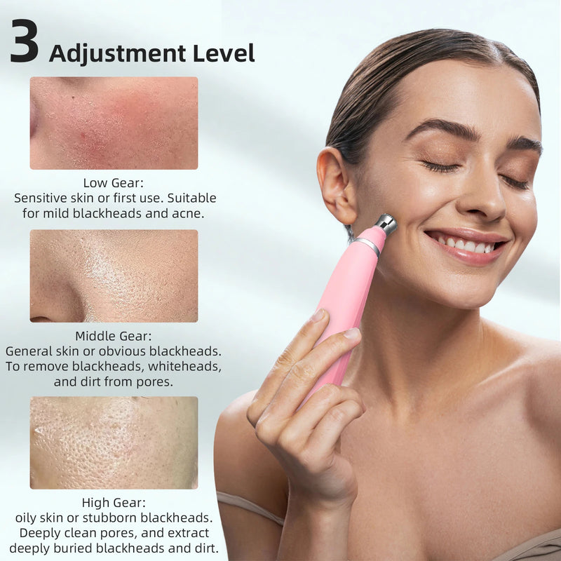 Máquina portátil de microdermoabrasão de diamante, dispositivo de peeling facial, esfoliação a vácuo, removedor de cravos com 4 pontas de peeling de diamante