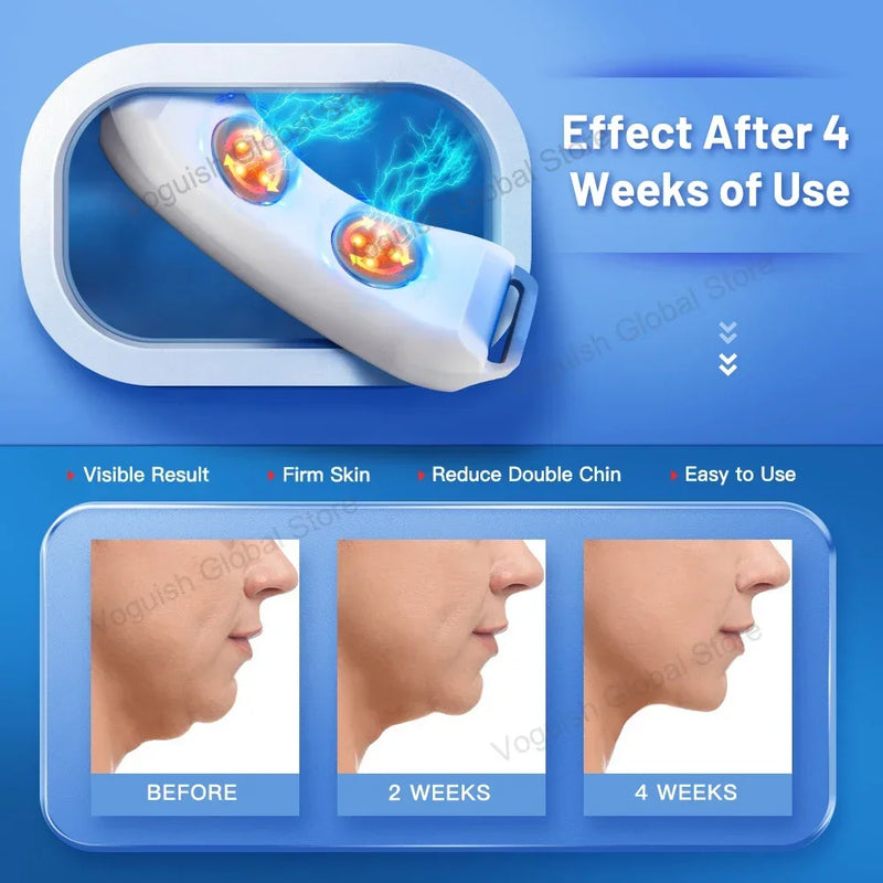 Removedor de queixo duplo, vibração, queixo para cima, massageador facial em V, levantador facial EMS, dispositivo de beleza, cinto modelador de lifting facial em V
