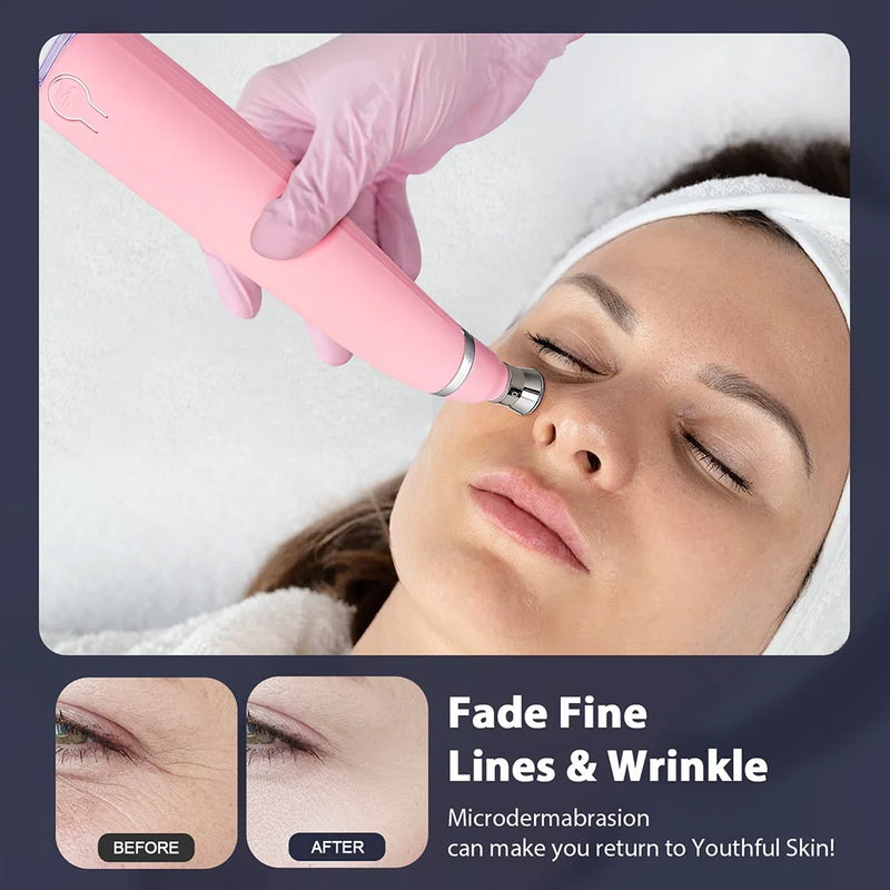 Máquina portátil de microdermoabrasão de diamante, dispositivo de peeling facial, esfoliação a vácuo, removedor de cravos com 4 pontas de peeling de diamante