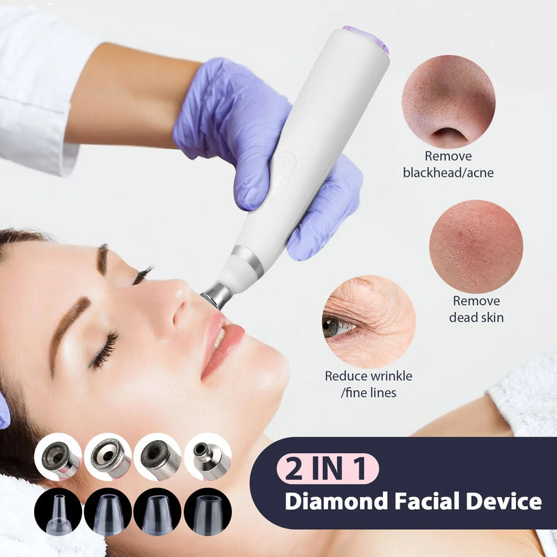 Máquina portátil de microdermoabrasão de diamante, dispositivo de peeling facial, esfoliação a vácuo, removedor de cravos com 4 pontas de peeling de diamante