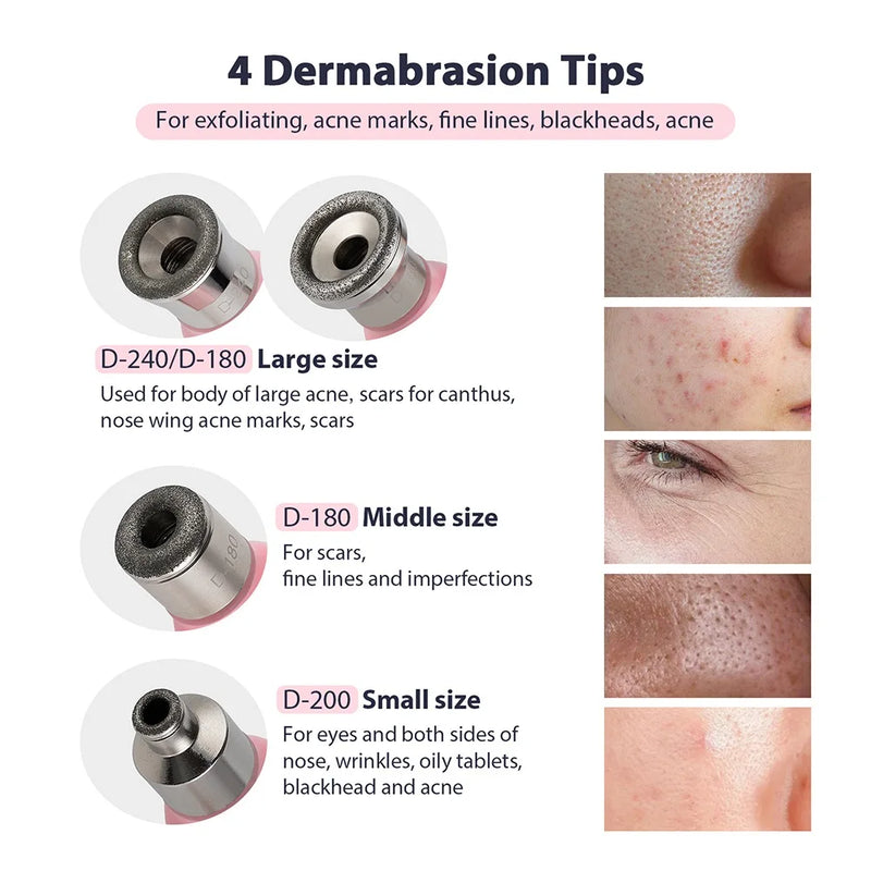 Máquina portátil de microdermoabrasão de diamante, dispositivo de peeling facial, esfoliação a vácuo, removedor de cravos com 4 pontas de peeling de diamante