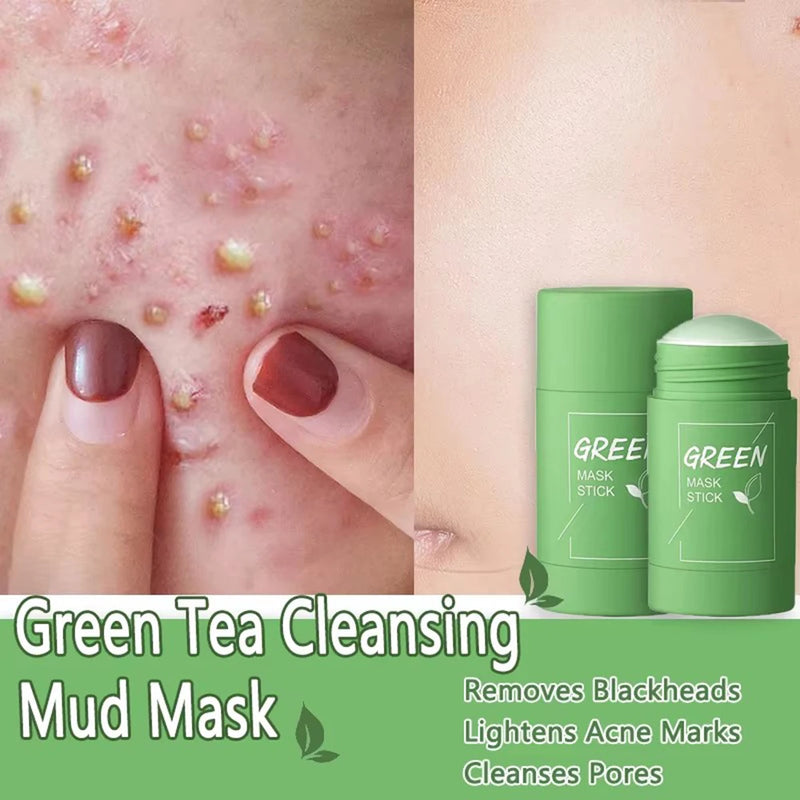 Máscara Facial Original Removedora de Cravos e Chá Verde Sólida, Trata Acne, Manchas e Pontos Pretos, Creme em Bastão para Limpeza, Diminui Poros e Cuidados com a Pele